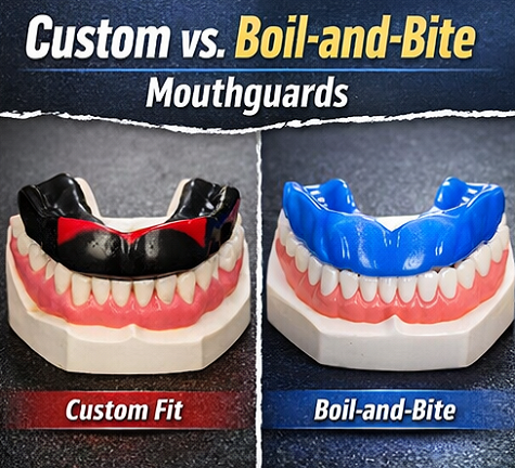 Custom vs Boil-and-Bite Mouthguards – What’s the Difference?